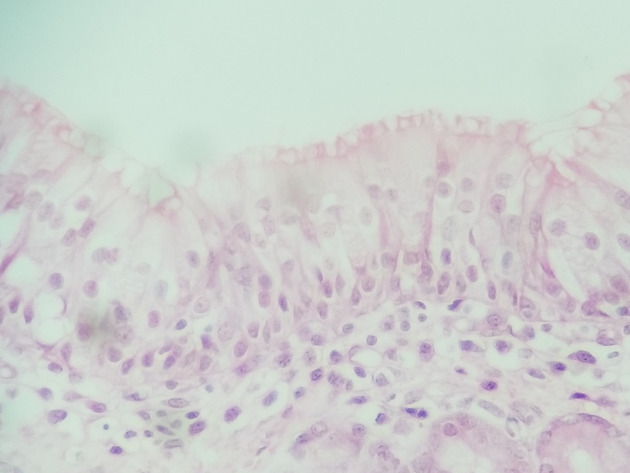 Pseudostratified Epithelium Slides - Pseudostratified Epithelium 09 400X